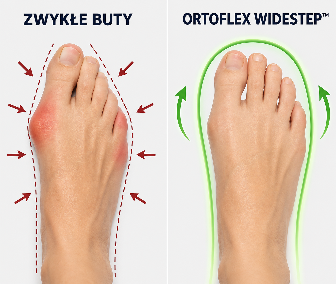 Zwykłe buty vs Ortoflex WideStep™
